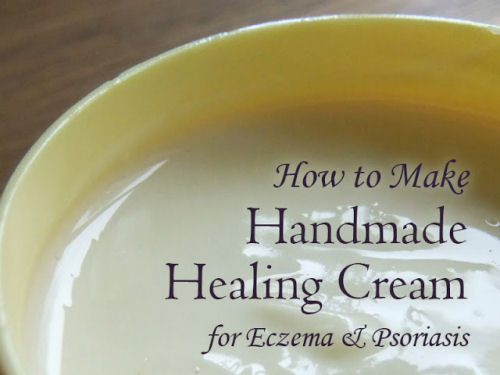 Handmande healing cream for eczema and psoriasis from lovelygreens.com