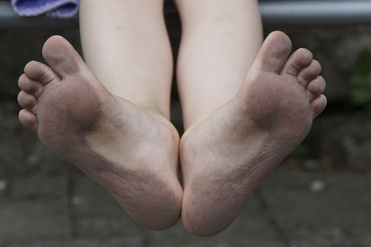 dirty feet