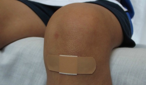use coconut oil to soothe minor wounds