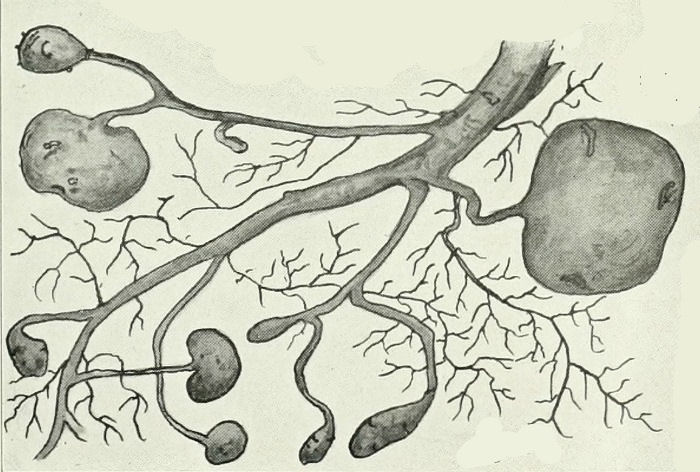 Tubers